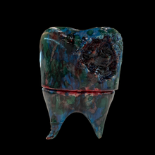 Load image into Gallery viewer, Zombie series tooth decay (blue eyes) by @moucoyama
